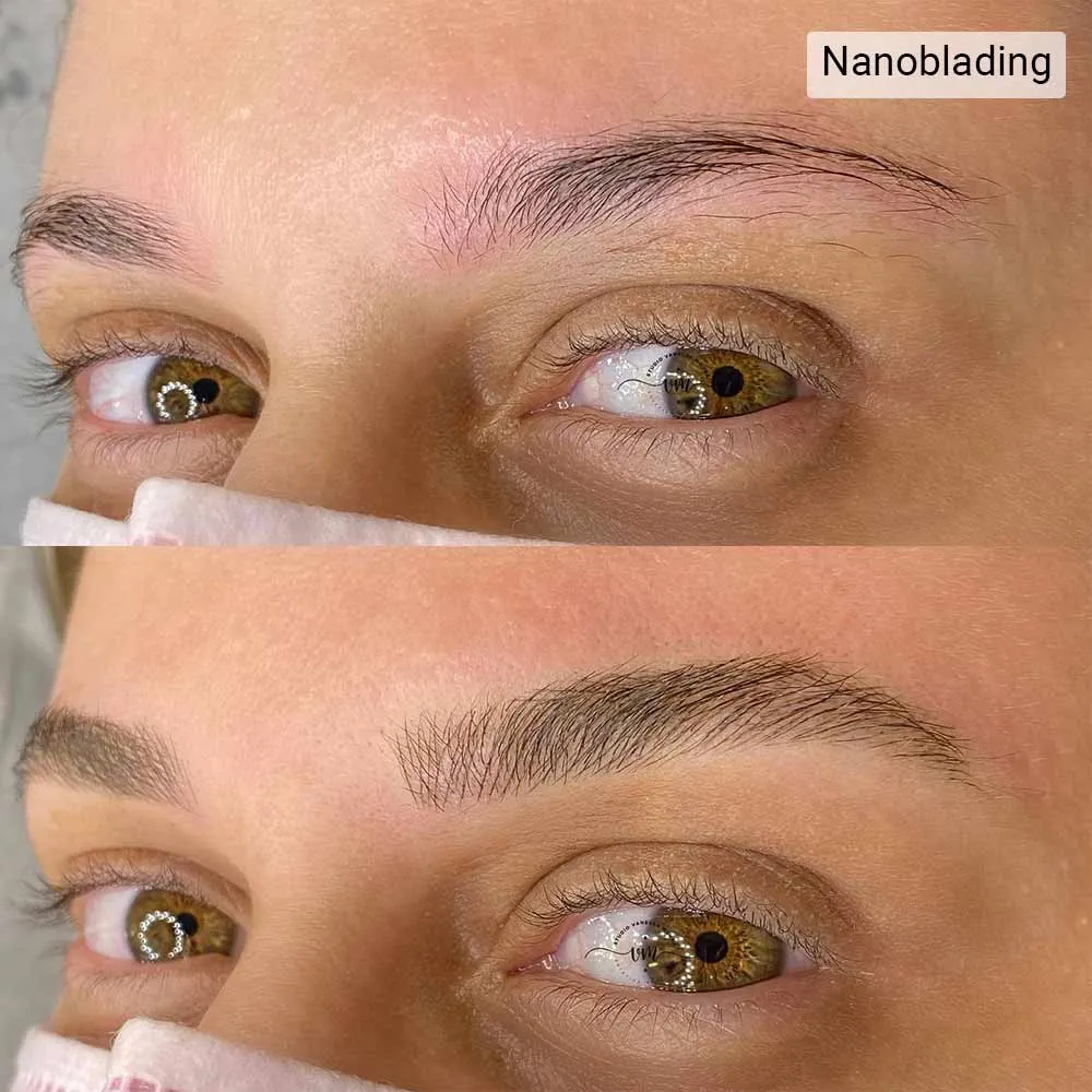 Nanoblading vs Microblading Longevity