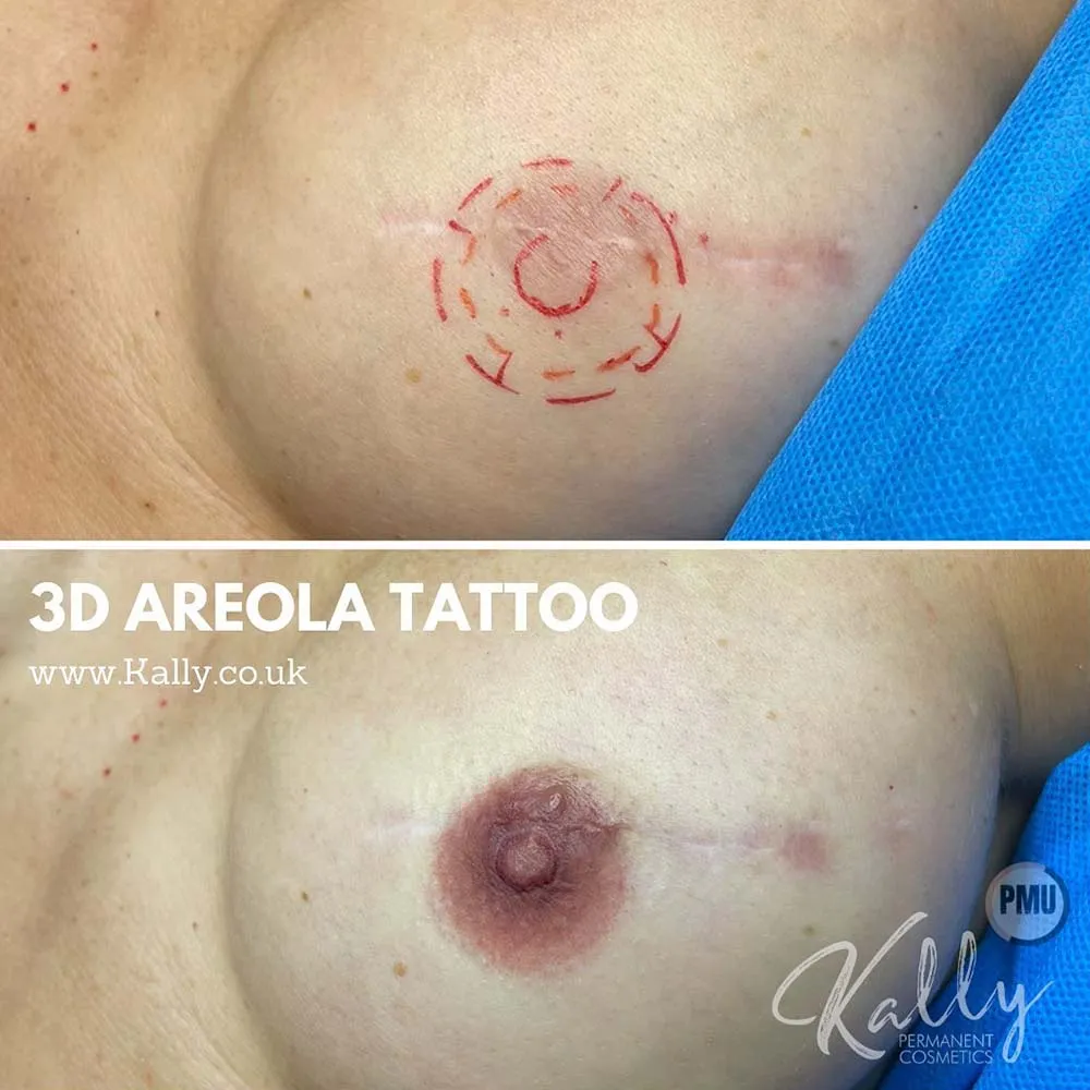 Did you know that areola tattoos can appear realistic?? Are you intere