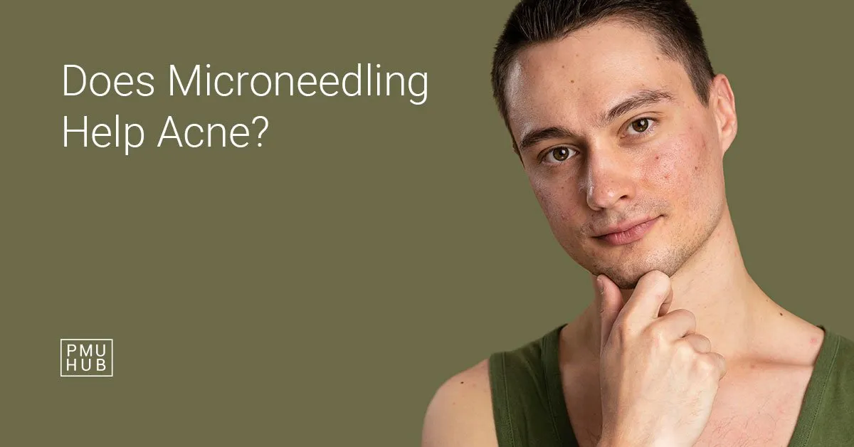 does microneedling help acne