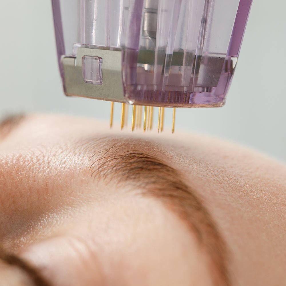 How Deep Does Microneedling Go?  
