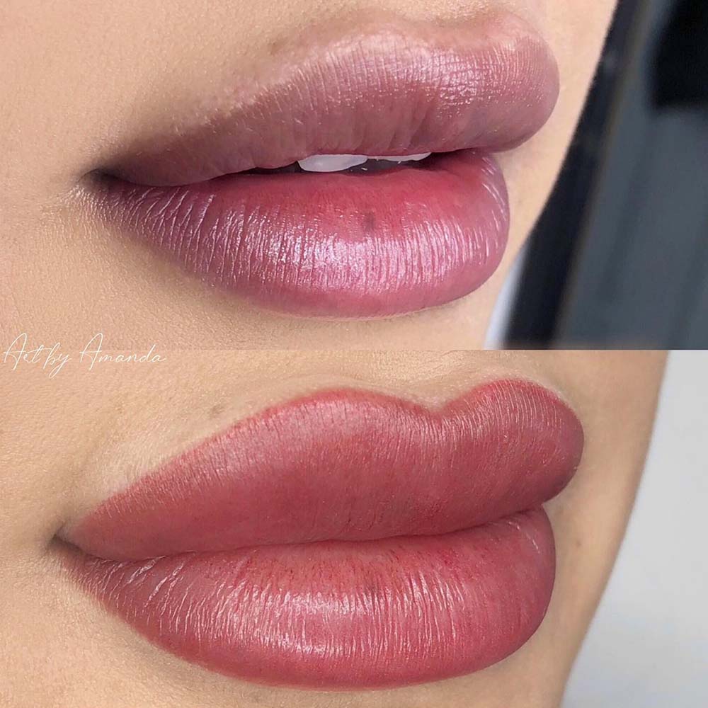 Lip Blush Before Or After Fillers