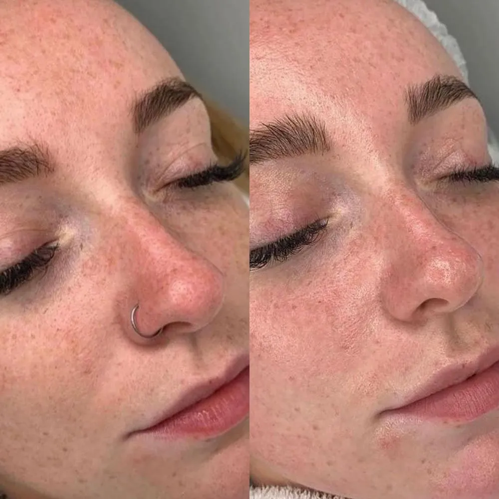 AHA vs BHA