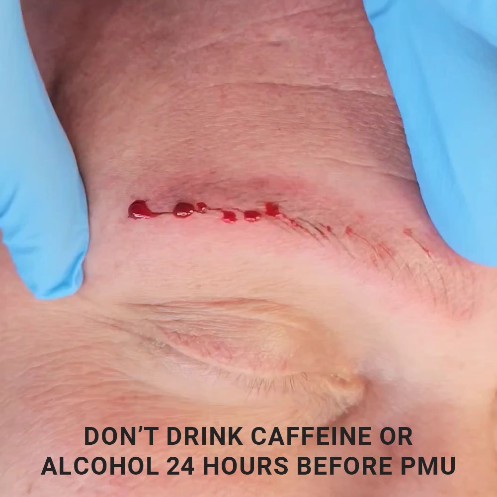 Bleeding during microblading caused by caffeine or alcohol