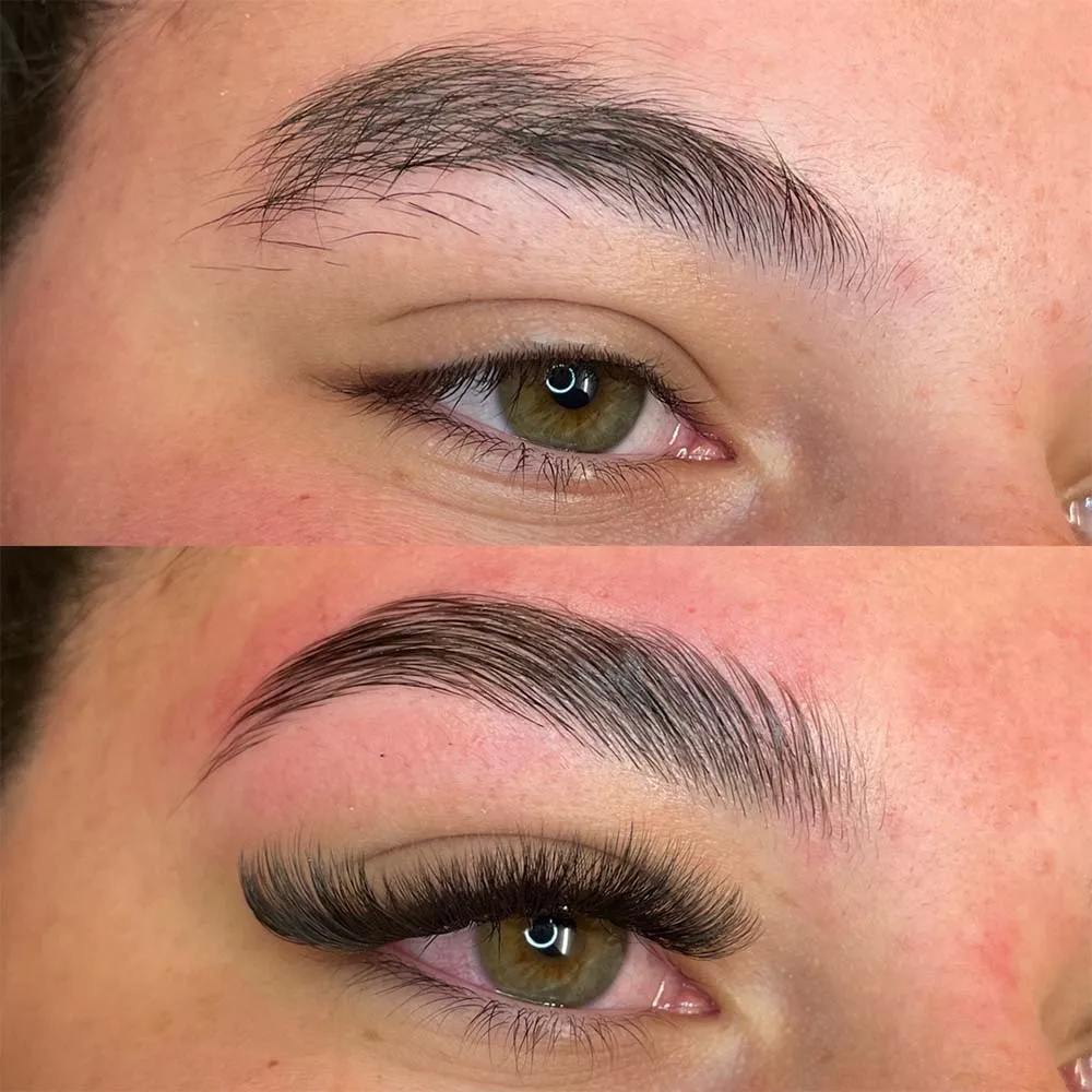 how to get rid of swollen eyes after lash extensions
