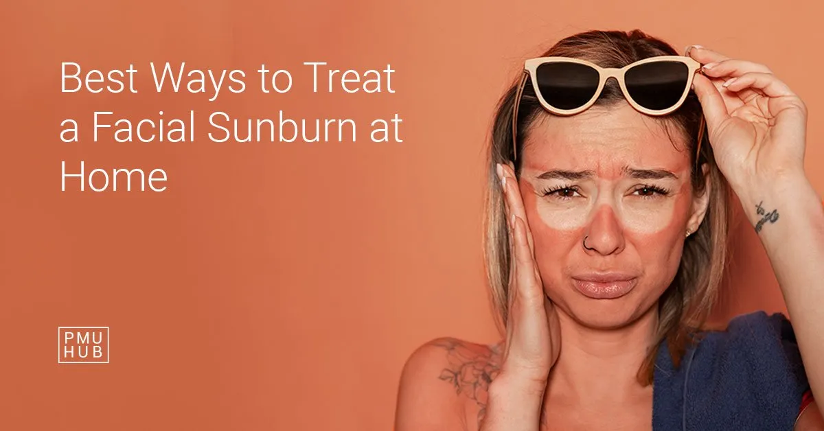 how to treat facial sunburn