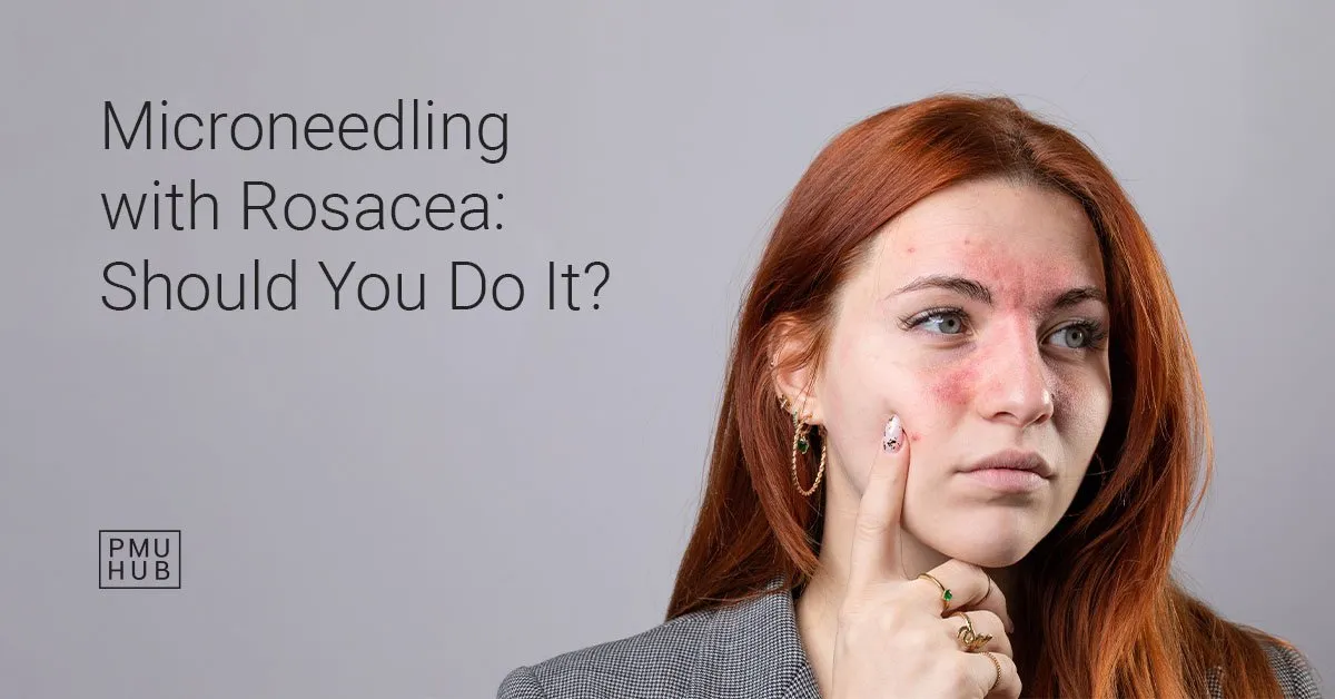 Microneedling rosacea