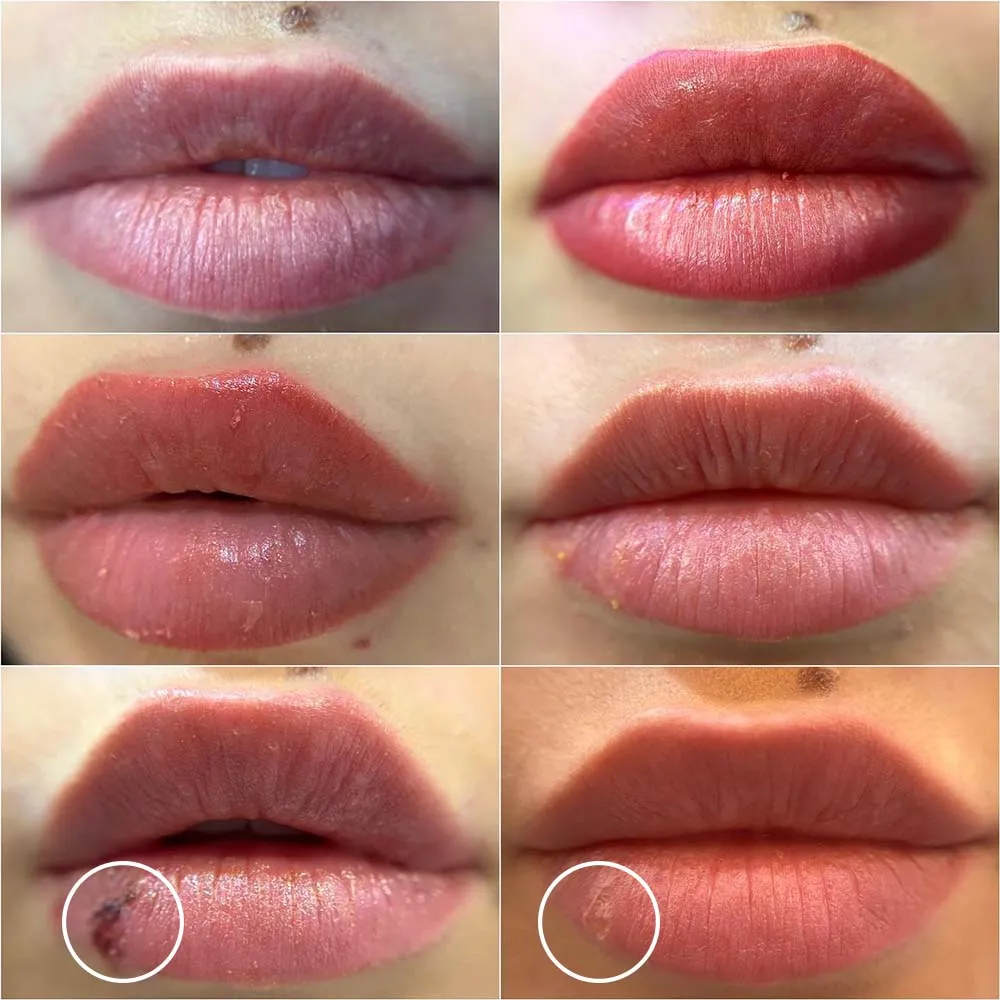 Lip Blush by Kim @kimnhungofficial #lipblush #lipsfordays #colorcorrection  #lipcorrection #pmu #lipstick #lips #lipstattoo…