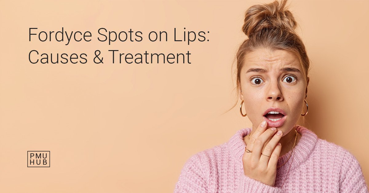 fordyce spots on lips