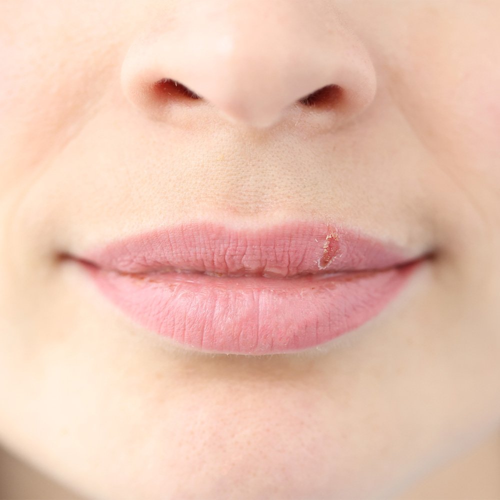 lip blush gone wrong