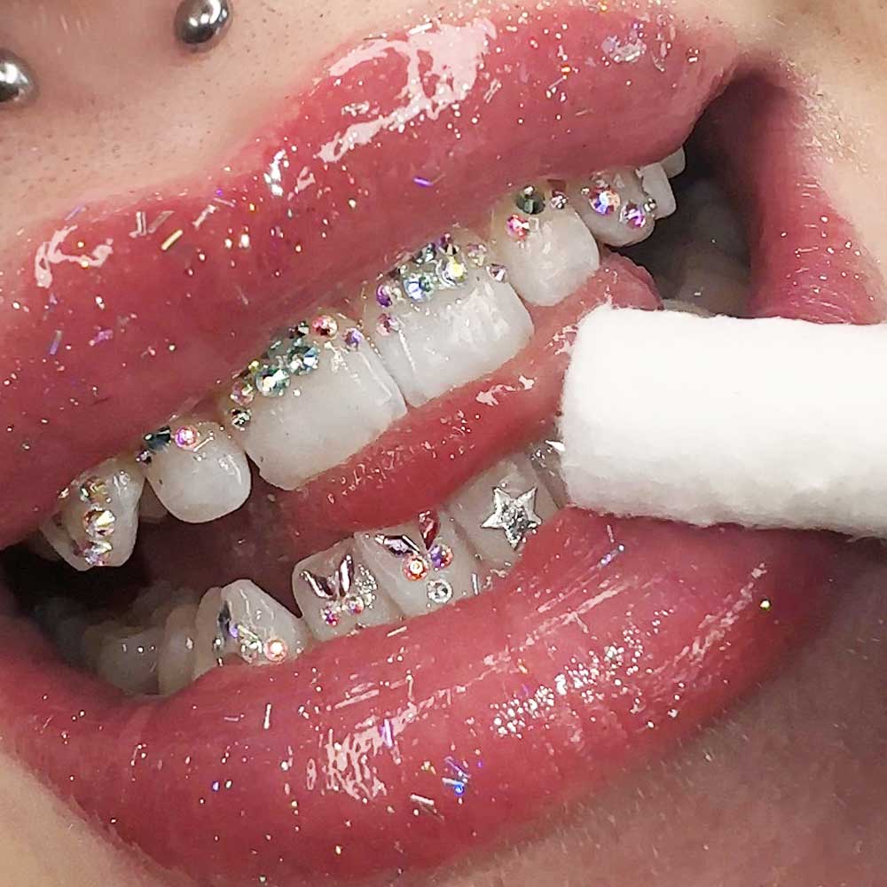 Tooth Gems All You Should Know About Teeth Jewelry