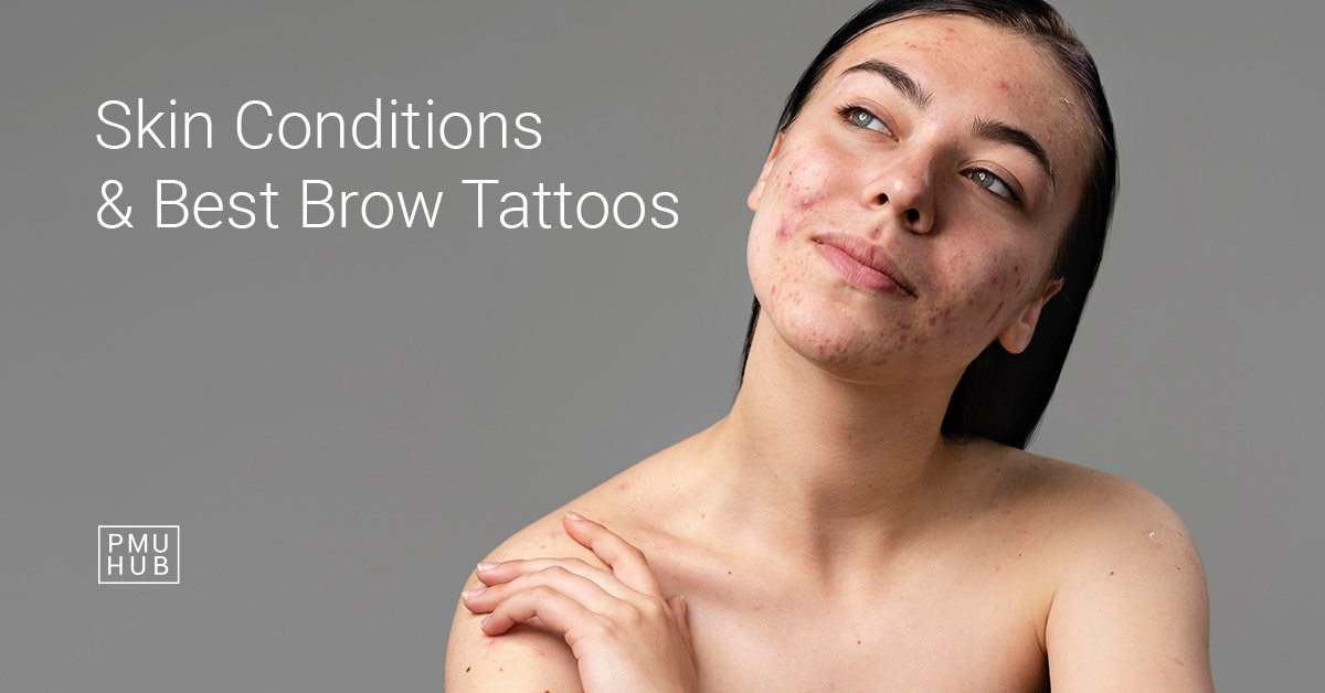 skin conditions & best brow tattoos