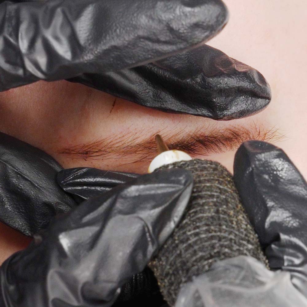 Nano stroking procedure